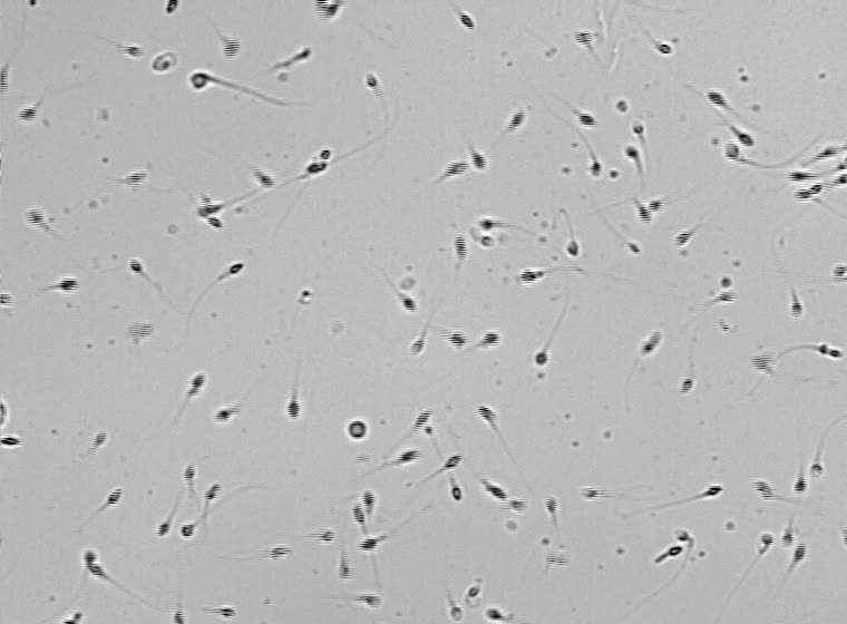 Спермограмма - быстрый результат
